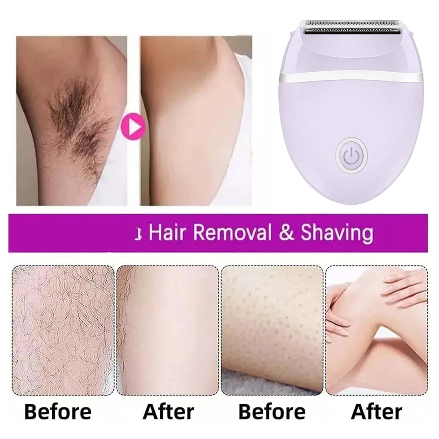 Electric Skin Hair Remover for Women Painless Private & Body Hair Removal Device for Women Summer Hair Removal Skin Care