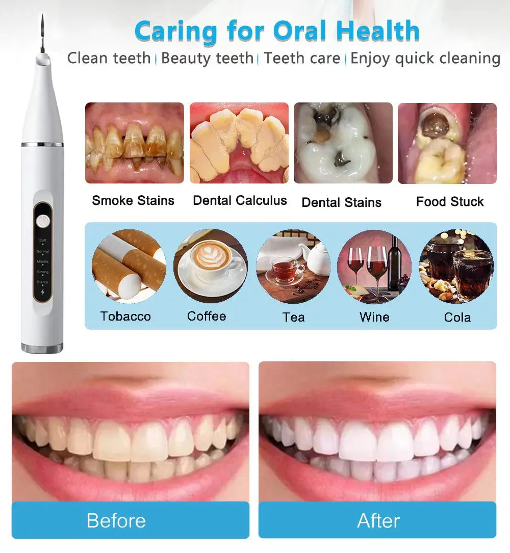 Ultrasonic Dental ScalerElectric Teeth Cleaning Tools Clean Tartar Smoke Stains Adult Oral 5 Mode Cleaning Care Tools