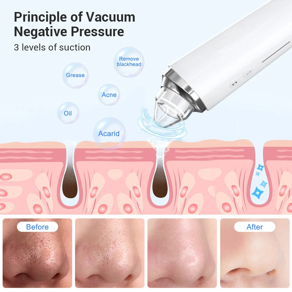Blackhead Remover Vacuum Acne Cleaner Black Spots Removal Facial Deep Cleansing Pore Cleaner Beauty Machine Skin Care Tools