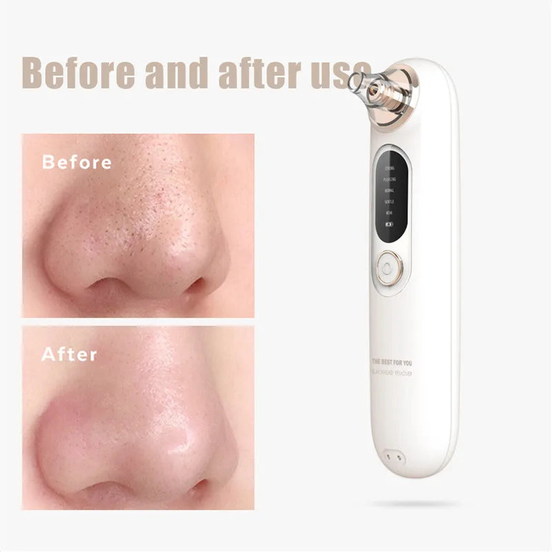 Electric Pore Nose Cleaner Portable Mini Facial Whitehead Blackhead Remover Vacuum Machine Deep Face Cleaning Tool