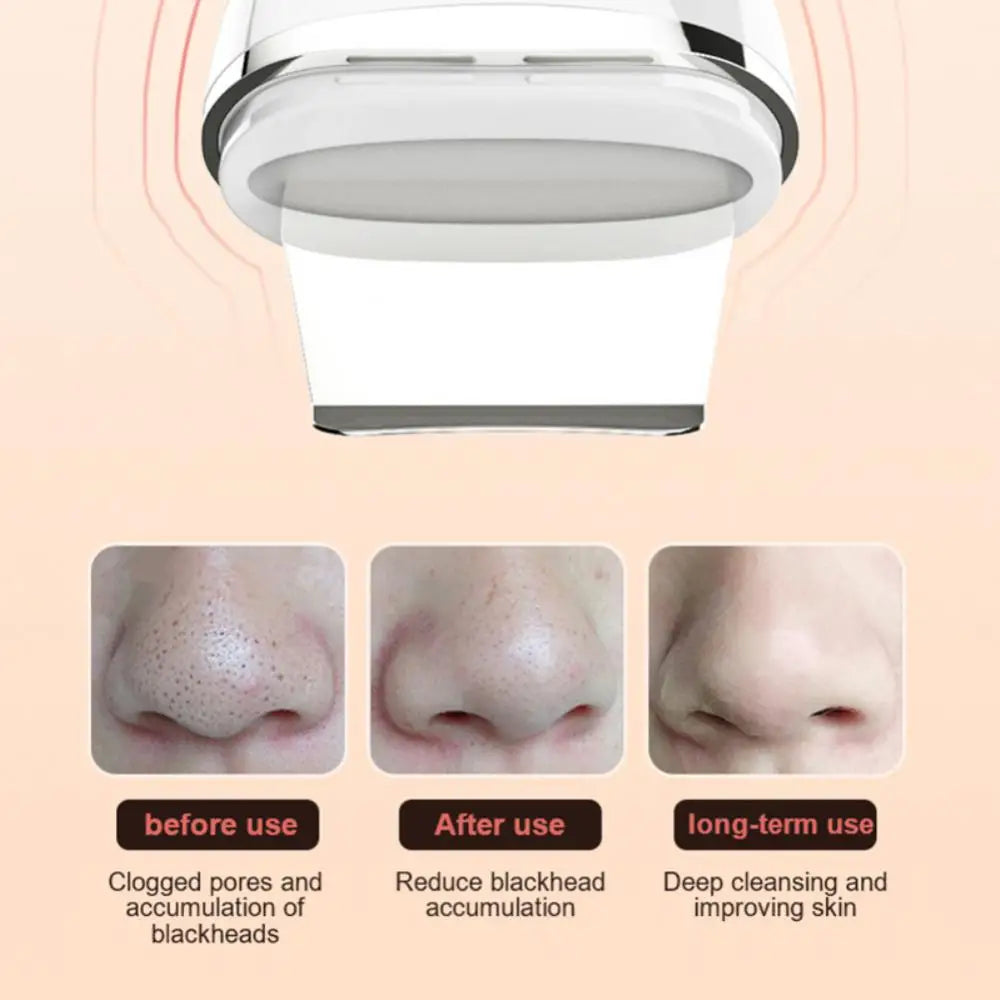 Ultrasonic Skin Scrubber Deep Face Cleaning Machine Peeling Shovel Facial Pore Cleaner Face Skin Scrubber Lift Machine