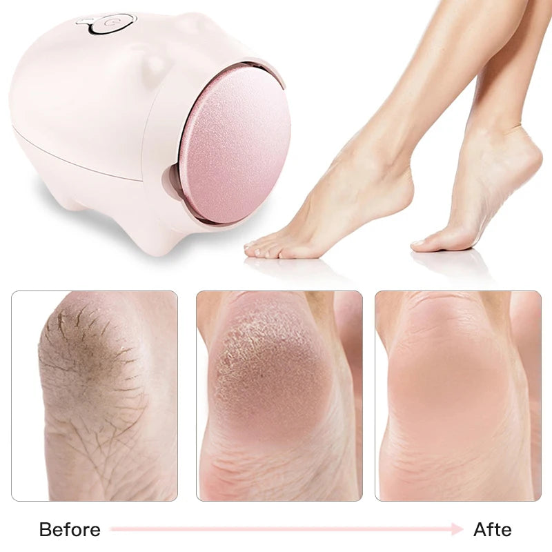 New Electric Foot Grinder for Removing Dead Skin Cocoon Cuticle Layer Foot Repair Machine Rechargeable Skin Grinding Tool