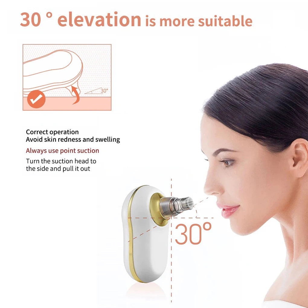 Blackhead Acne Remover Set Home Salon Portable Facial Pore Black Spot Vacuum Cleaning Exfoliating Tool Beauty Supplies