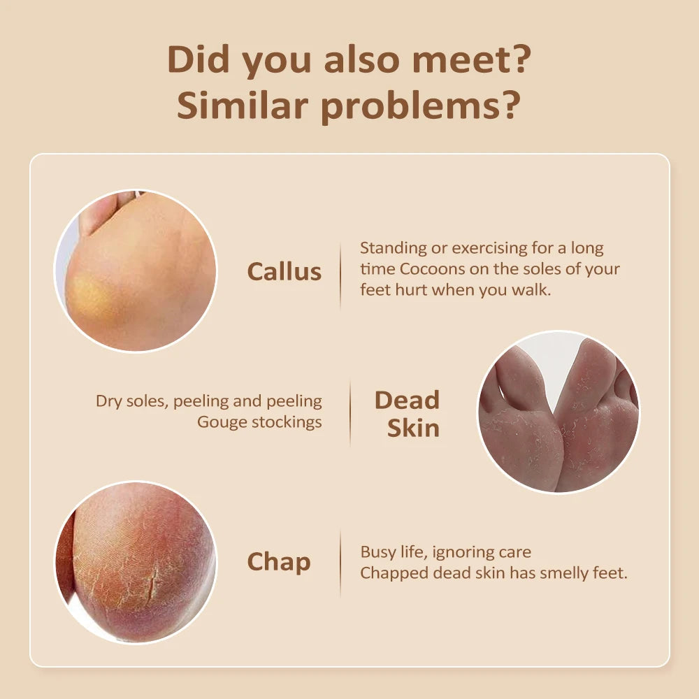 Electric Foot Grinder for Feet Heels Care Automatic Foot Exfoliator File Polish Nails Pedicure Machine Callus Dead Skin Remove