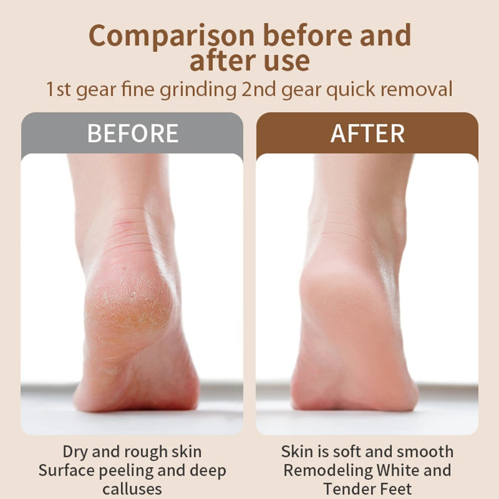 Electric Foot Grinder for Feet Heels Care Automatic Foot Exfoliator File Polish Nails Pedicure Machine Callus Dead Skin Remove