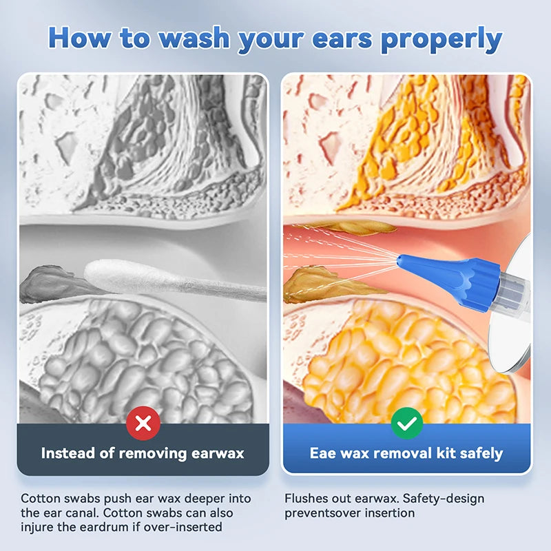 Ear Wax Removal Tool Manual Ear Irrigation Flushing System Safe And Effective Ear Cleaner For Adults Kids Cleaning Washer Kit