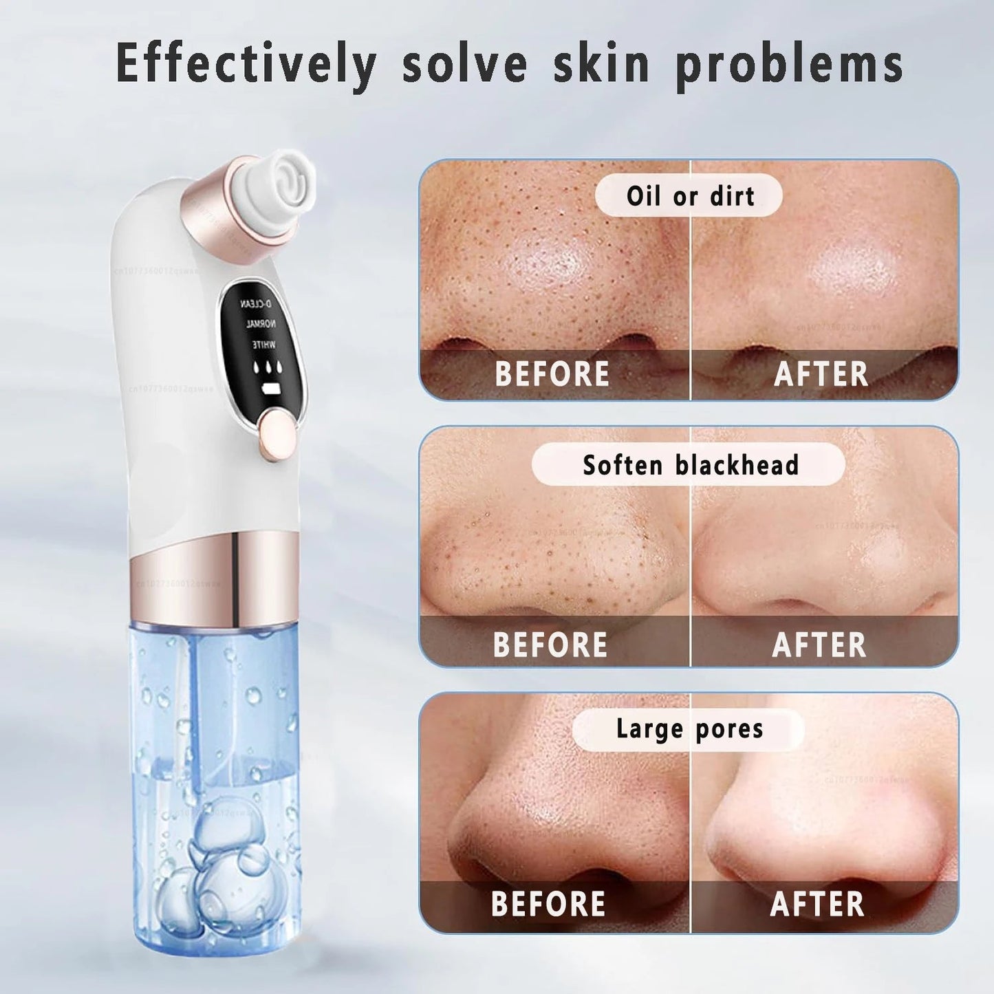 Blackhead Remover Pore Vacuum Face Nose Deep Cleaning Electric Pimple Black Head Removal Rechargeable Facial Pore Cleaner