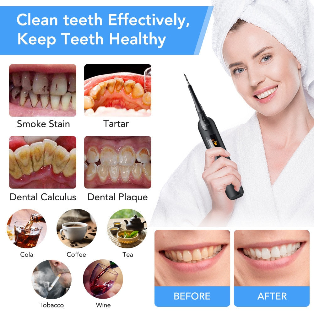 Electric Dental Calculus Remover LED Display Rechargeable Sonic Dental Scaler Tooth Cleaner Tartar Removal Teeth Whitening Tools