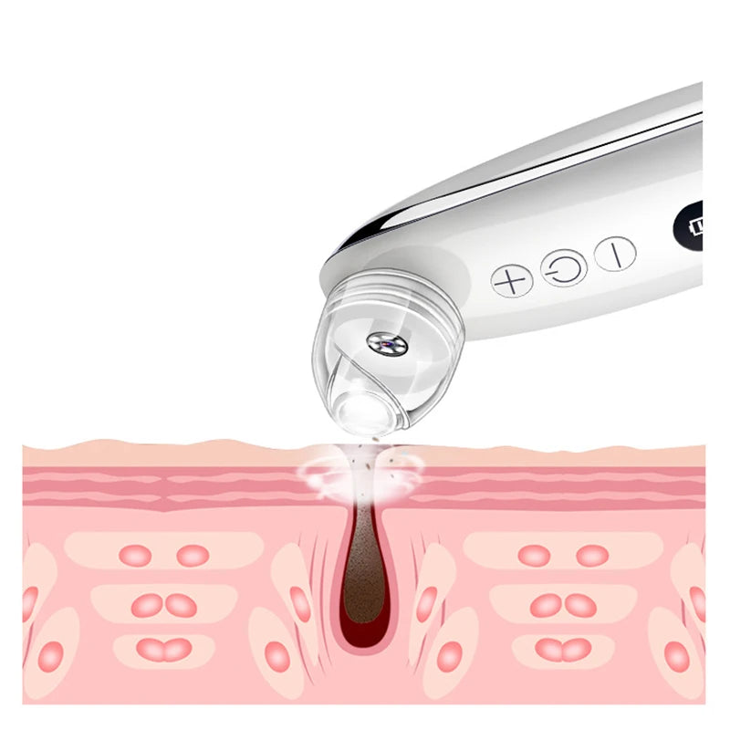 Visual Blackhead Vacuum Kit With Charging Base HD Camera 6-Level Skin Deep Cleaning Black Spots Strong Vacuum Suction