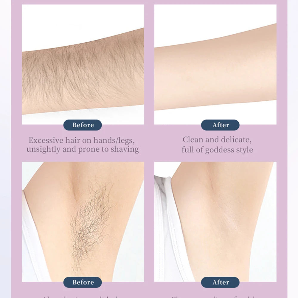 Hair Removal Bikini Epilator Rechargeable Razor Women Underarms Shaver Legs Armpit Hair Foot Callus Remover