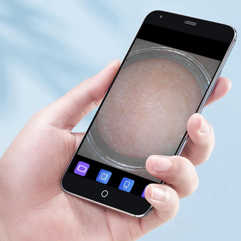 Visual Blackhead Vacuum Kit With Charging Base HD Camera 6-Level Skin Deep Cleaning Black Spots Strong Vacuum Suction