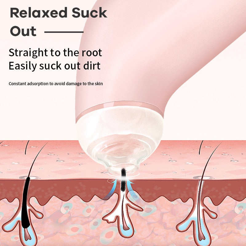 Blackhead Remover Vacuum Acne Pimple Black Spot Suction Instrument Cleaner Electric Beauty Pore Exfoliating Skin Care