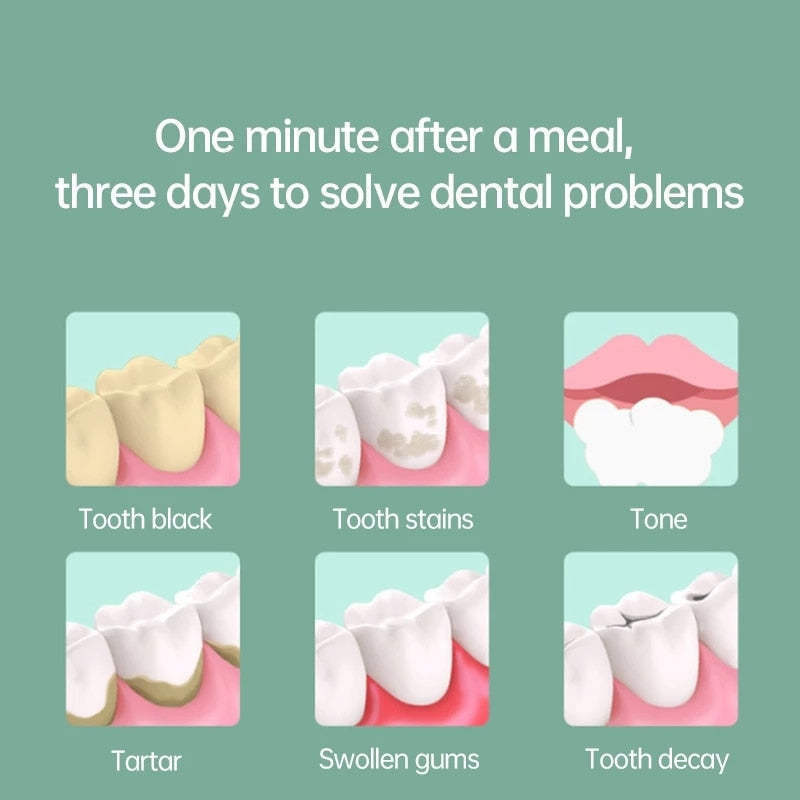 Portable Oral Irrigator Pulse Dental Water Flosser USB Rechargeable Water Jet 280ml Water Tank Waterproof Teeth Cleaner