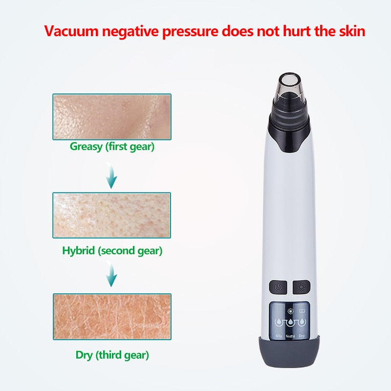 Electric Blackhead Remover Facial Pore Cleaner with Heating Vacuum Suction Diamond T Zone Deep Cleaning Pimple Removal Machine