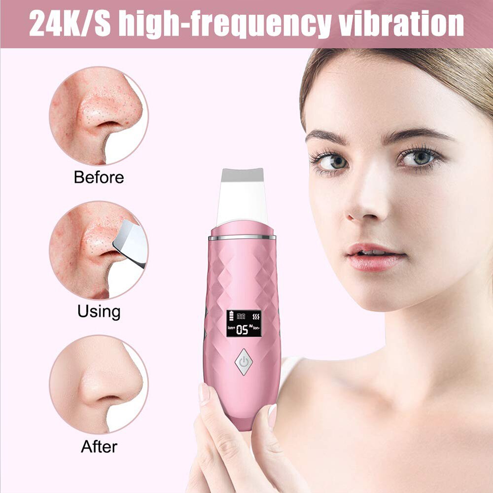 EMS Skin Scrubber Ultrasonic Facial Skin Spatula Heating Facial Cleansing Blackhead Remover Extractor Face Cleaning Tool