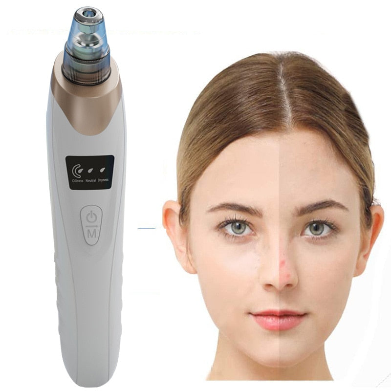 Electric Facial Blackhead Remover Vacuum Acne Spots Pore Black Dot Cleaner Pimple Remover Face Deep Cleaning Machine Beauty Tool