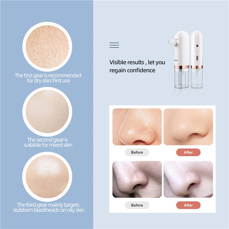 Electric Bubble Blackhead Remover Pore Vacuum Cleaner Water Cycle Face Vacuum Comedone Extractor Tool Acne Pimple Removal