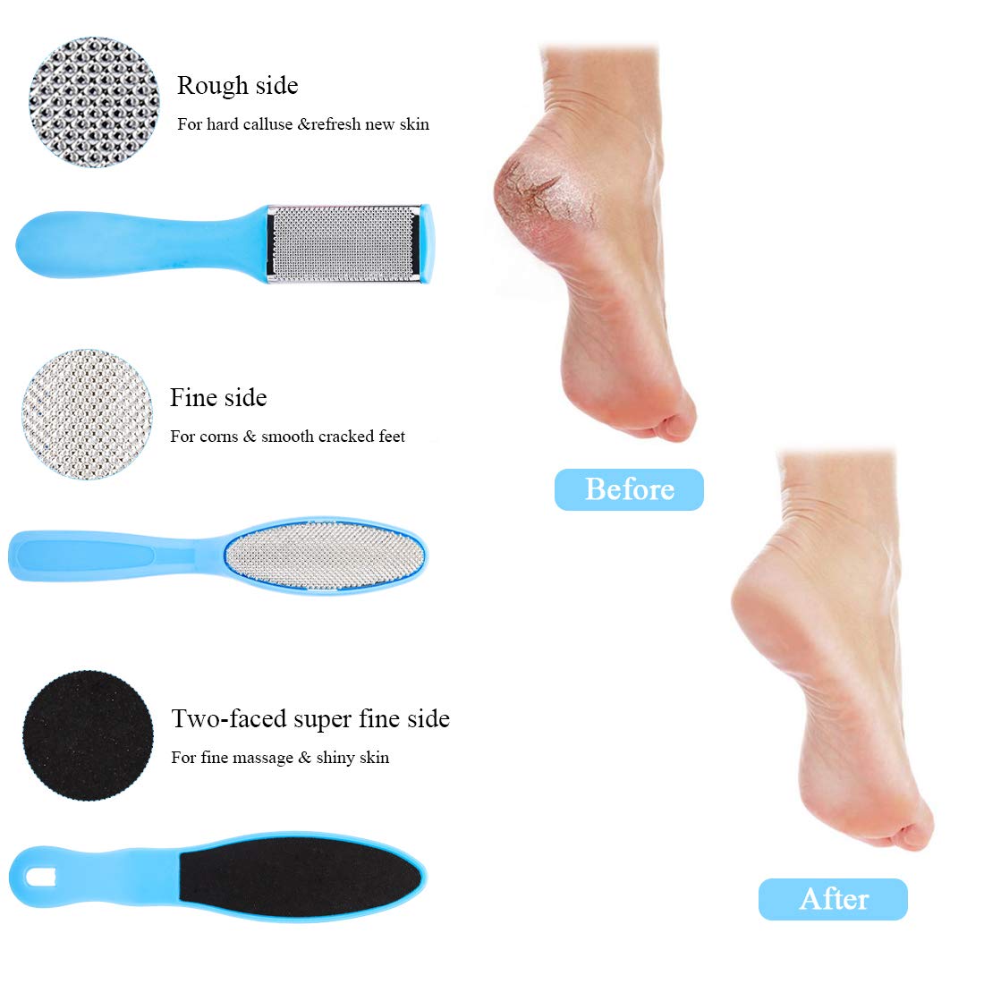 Professional Pedicure Kit 20 in 1 Professional Pedicure Tools Set Feet Scrubber Dead Skin Remover, Callus Remover for Foot Kit