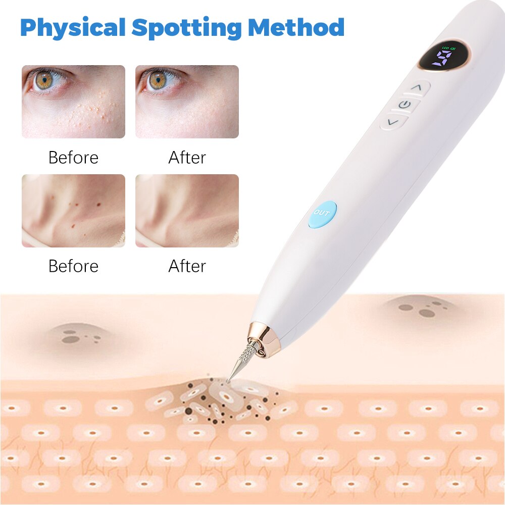 Mole Spot Scanning Pen Needle Light LED Screen 9-speed Tattoo Removal Plasma Pen Beauty Instrument