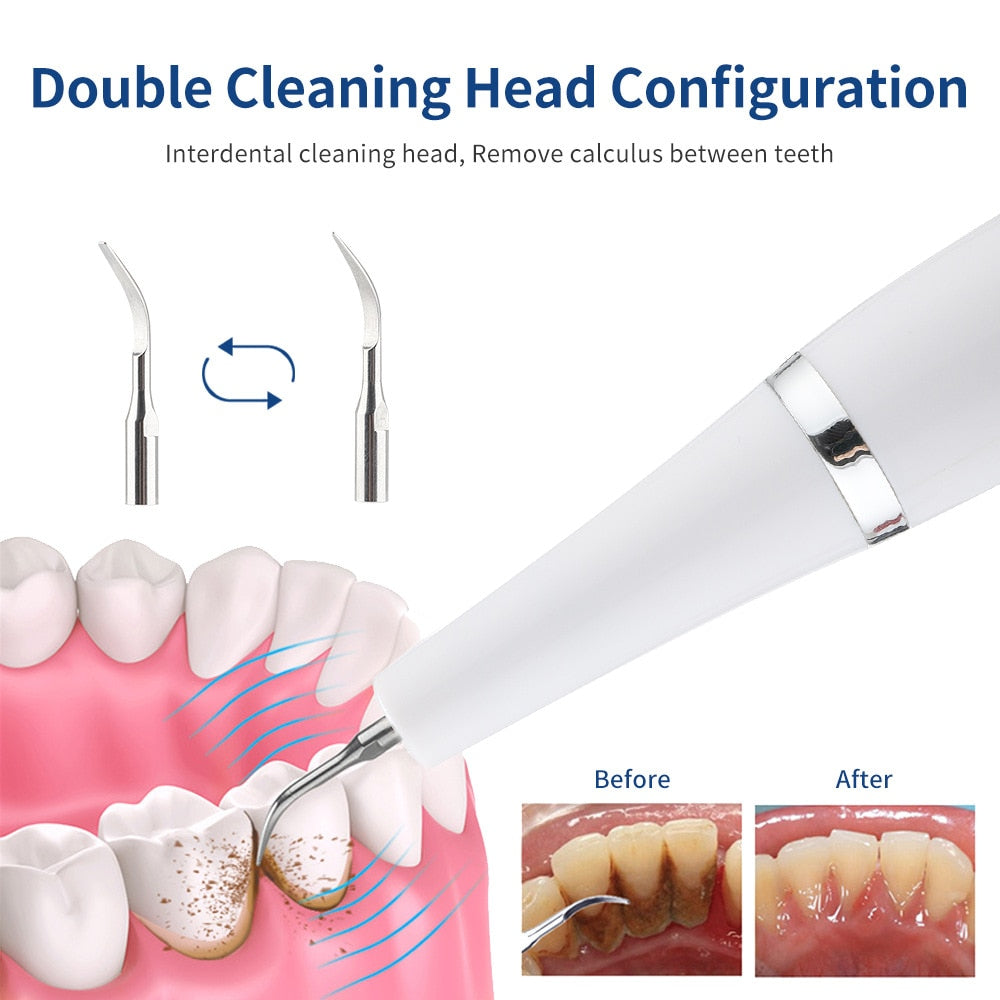 Electric Dental Calculus Scaler Remover Ultrasonic Teeth Cleaner Rechargeable 4 Mode Adults Stain Tartar Removal Teeth Whitening