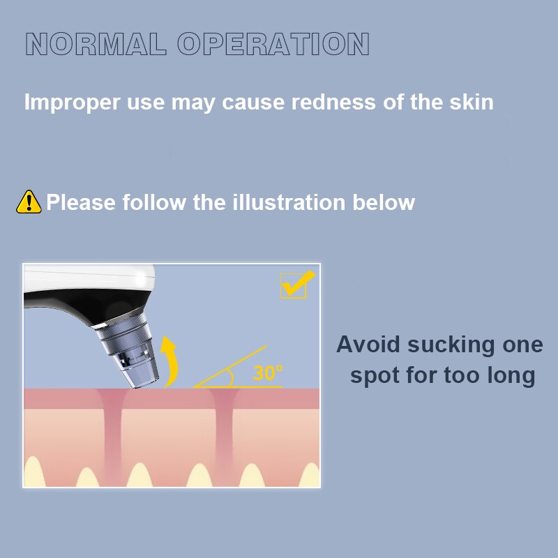 Blackhead Instrument Household Acne Removal Instrument Massage Pore Cleaning Instrument Electric Blackhead Suction Instrument