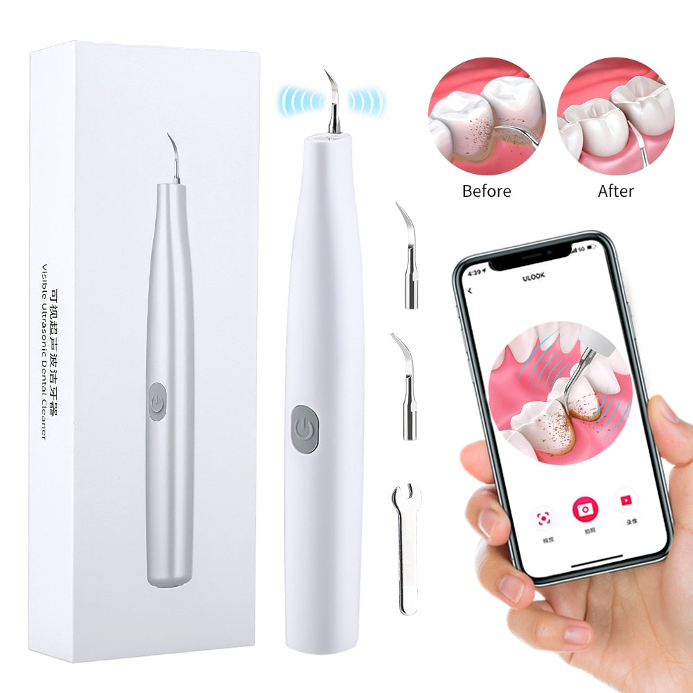 Ultrasonic Visual Dental Cleaning Teeth Whitening Kit Tartar Eliminator Scraper Scaling Tooth Cleaner Dental Calculus Removal