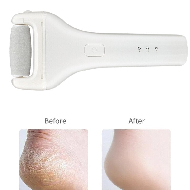 ABS Rechargeable Sharpener Pedicure Tool 2 Speeds Electronic Callus Removers