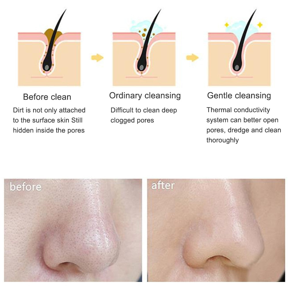 Electric cleanser Facial Cleansing Brush Face Skin Care Tools Waterproof Electric Sonic Cleanser Facial Beauty Massager