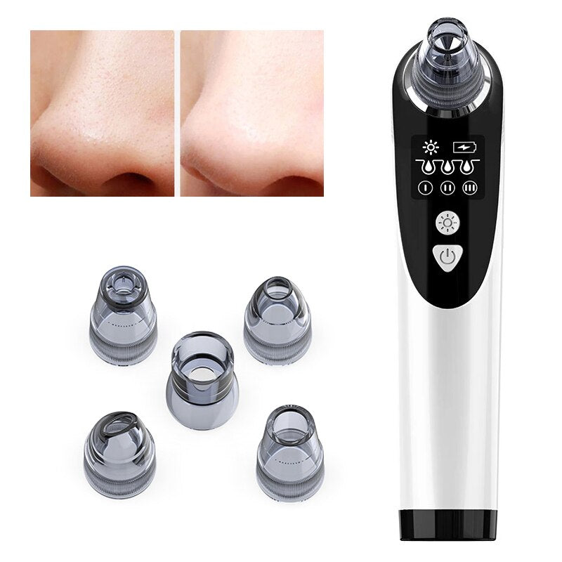 Blackhead Instrument Household Acne Removal Instrument Massage Pore Cleaning Instrument Electric Blackhead Suction Instrument
