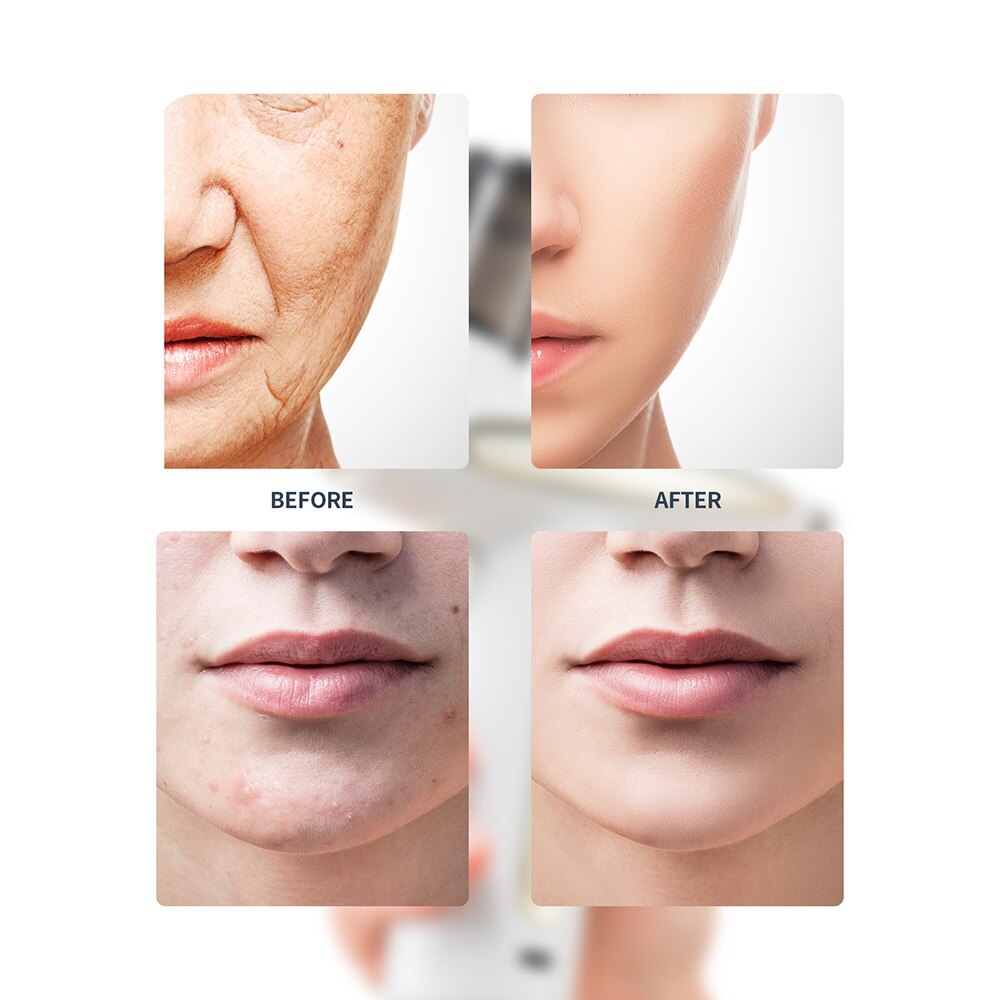 Portable Oxygen Injection Instrument Red Blue Light Face Steamer Humidifier Beauty Skin Care Tools High Pressure Water Sprayer