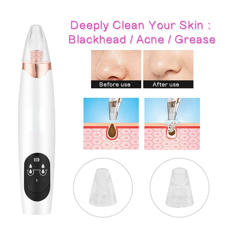 Electric Vacuum Suction Blackhead Remover Multifunction Deep Pore Cleaning Exfoliating Firming Facial Care Massager Beauty Tool